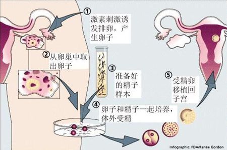 墨序生殖医学中心